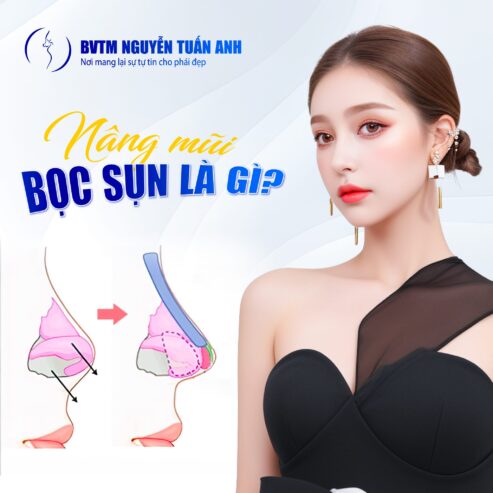 Nâng mũi bọc sụn tai có vĩnh viễn không?