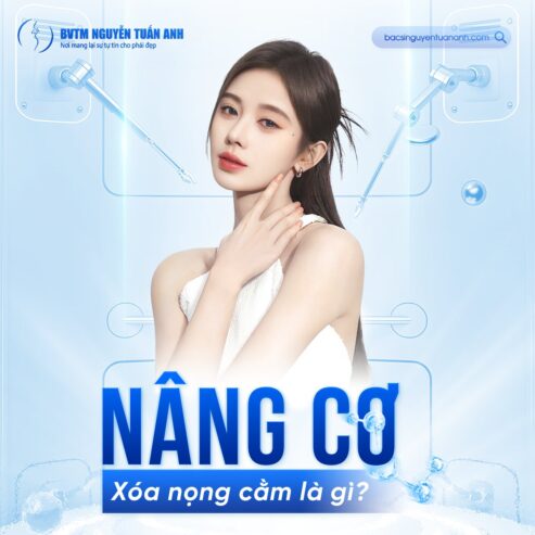 Phương pháp nâng cơ xóa nọng cằm là gì?