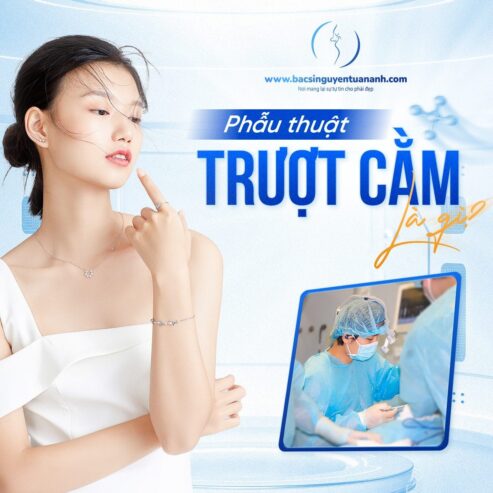 Lưu ý khi thực hiện phẫu thuật trượt cằm