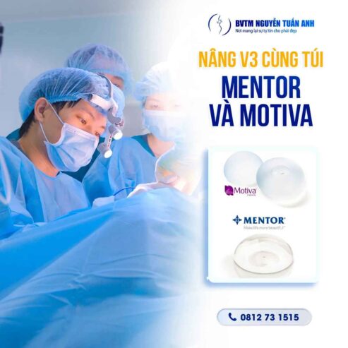 Túi Mentor và Motiva – Loại nào nâng cấp vòng 3 tốt nhất