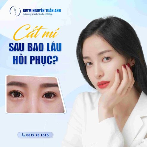 Lưu ý sau khi phẫu thuật thẩm mỹ mí mắt