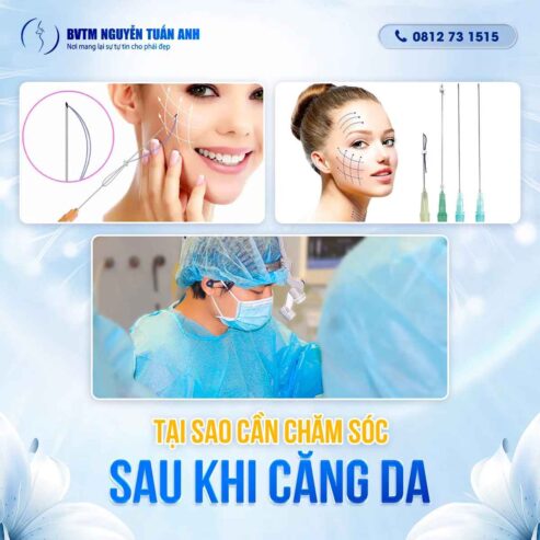 Tại sao cần chăm sóc sau khi căng da?