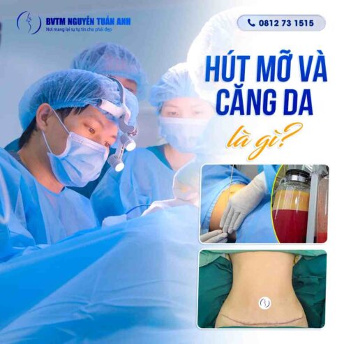 Kết hợp hút mỡ & căng da có nên hay không?