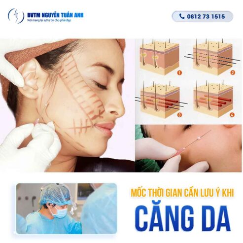 Thời gian hồi phục sau khi phẫu thuật thẩm mỹ căng da