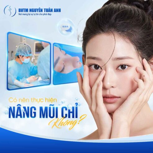 Có nên thực hiện nâng mũi chỉ không?