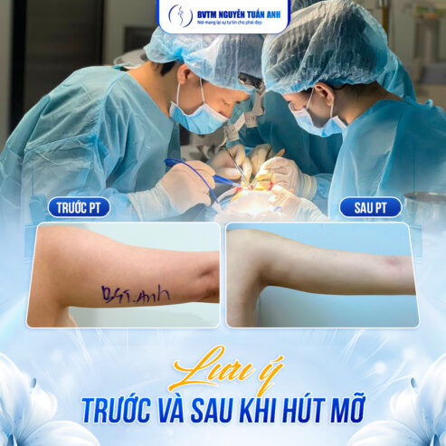 Bí quyết giảm mỡ để quyết định kế hoạch tự động