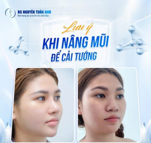 Nâng mũi cải tướng: Có đổi vận được thật không