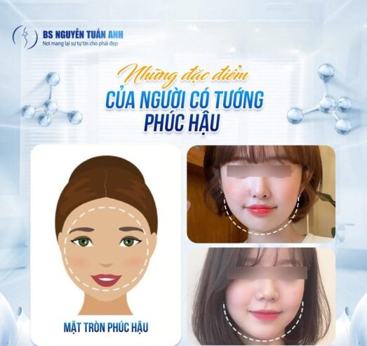 Có thể cải thiện qua nét mặt hay không