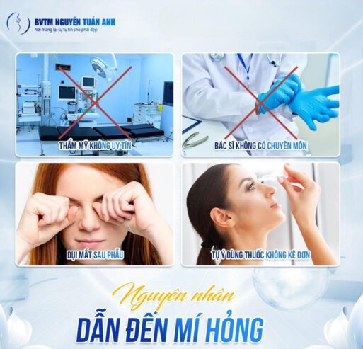 Nguyên nhân phổ biến dẫn đến mí hỏng